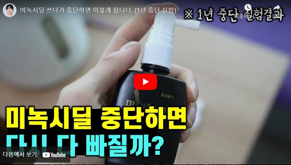 마이녹실 미녹시딜 중단 영향 영상