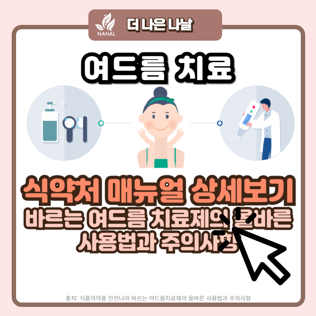 여드름 치료