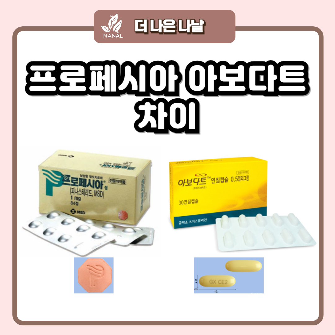 프로페시아 아보다트 차이
