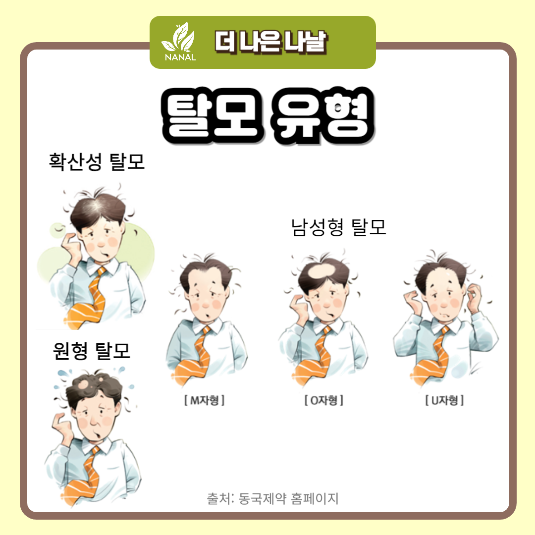 탈모유형
