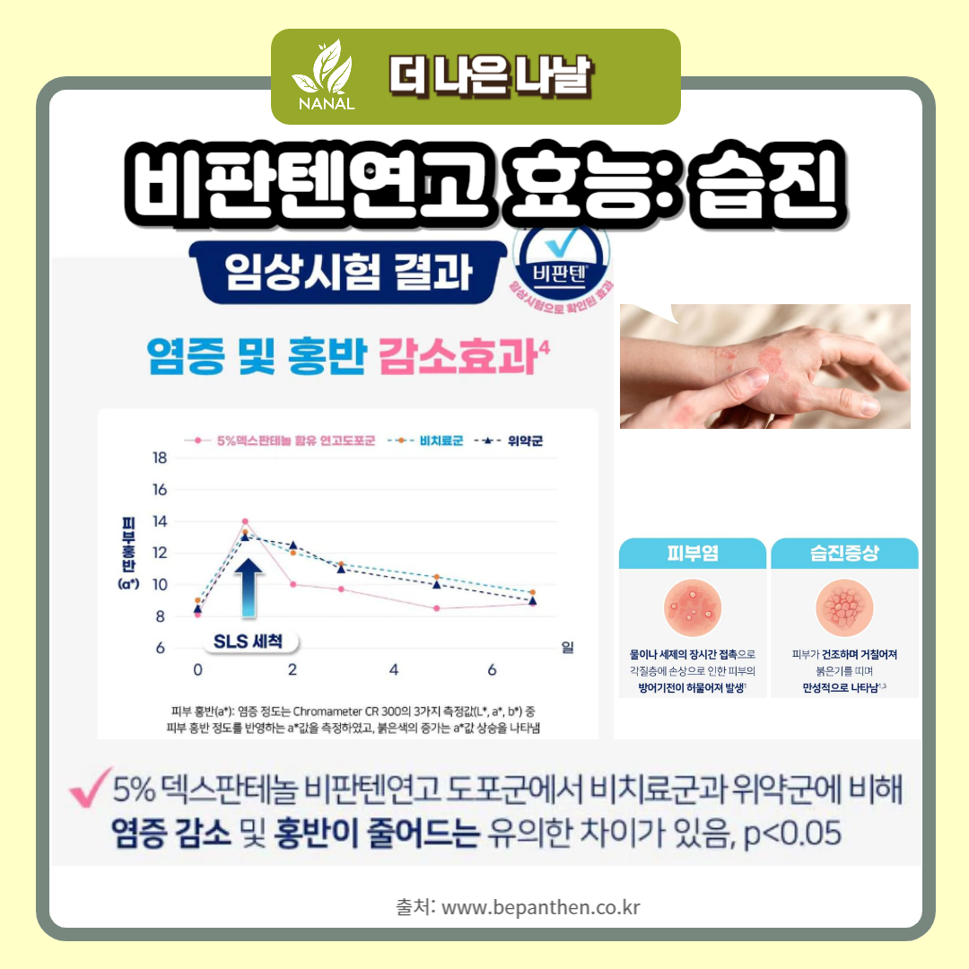 비판텐연고 효능 습진
