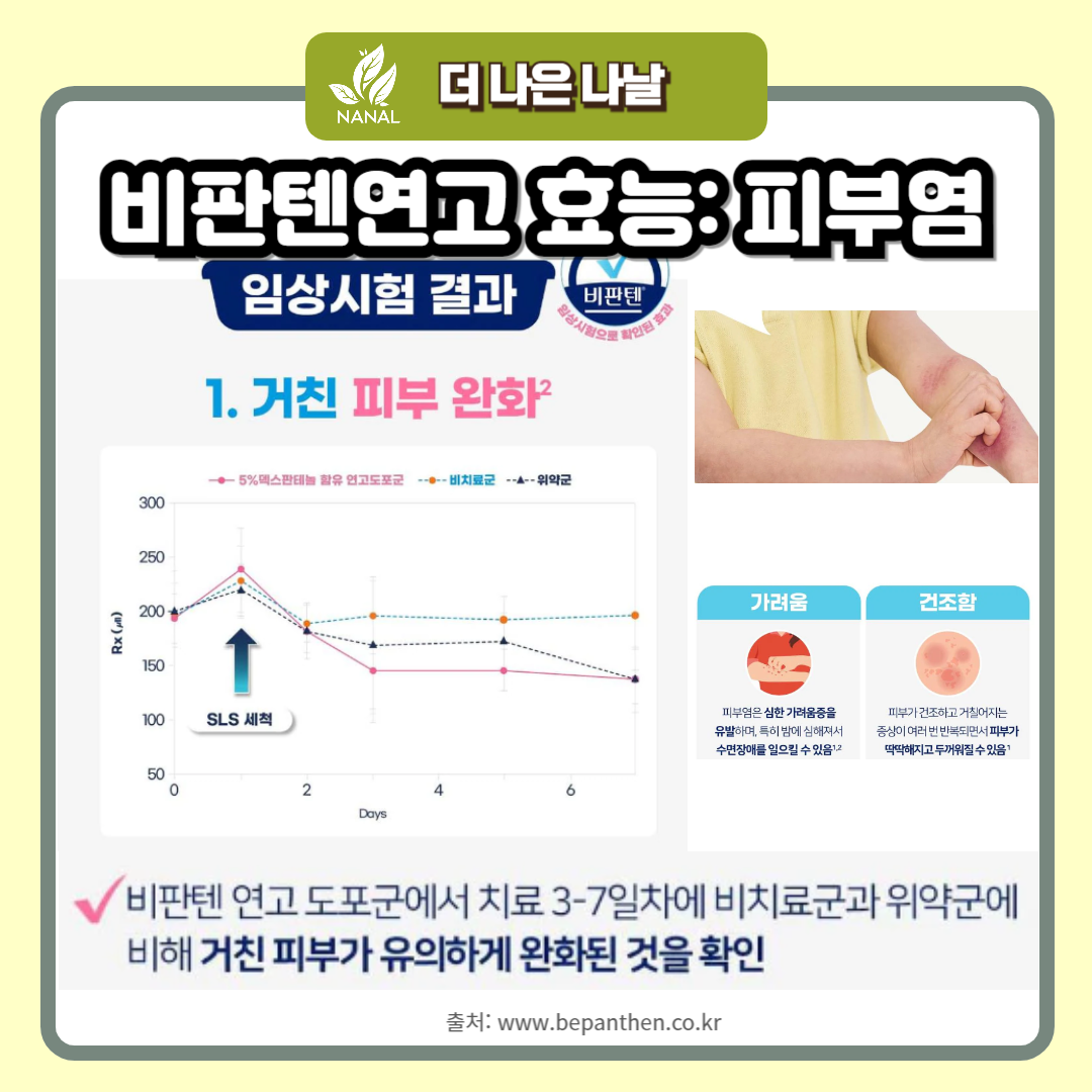 비판텐연고 효능 피부염