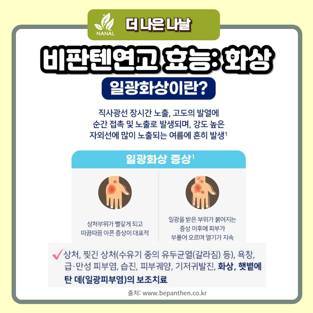 비판텐연고 효능 화상